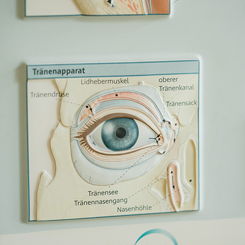 Augenarzt Diez - Augenzentrum Diez - A. Zimmermann - Praxis - Tränenapparat